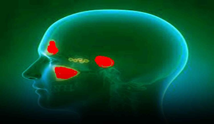 Sinus Treatment: इन लोगों को करवानी पड़ती है साइनस की सर्जरी, नहीं तो हो सकता है ये नुकसान