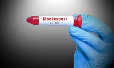 Monkeypox Symptoms: दिल्ली के बाद केरल में भी मिला मंकीपॉक्स का केस, दुबई से लौटा था शख्स