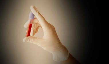 Key Diagnostic Tests: जिंदगीभर रहना है बीमारियों से दूर तो समय पर करवा लें ये टेस्ट, जानें क्यों हैं इतने जरूरी